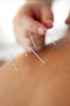 Documentation for Acupuncture
